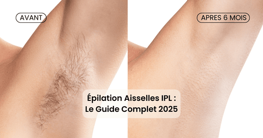 Épilation Aisselles Lumière Pulsée : Guide Complet 2025 - Lumizia